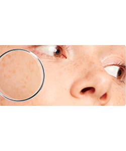 Алергічна та подразнена шкіра 