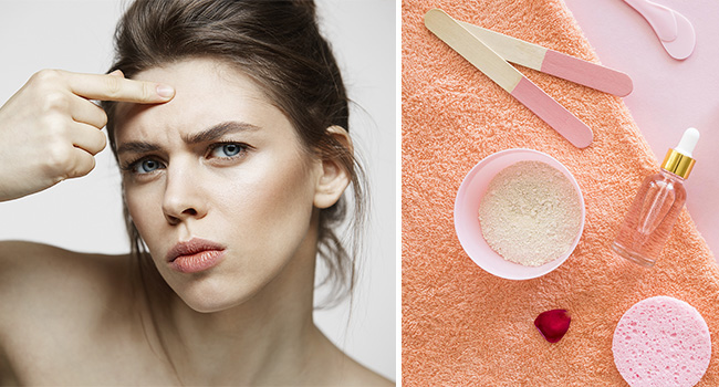 Проблемная кожа с акне: причины, лечение, уход фото