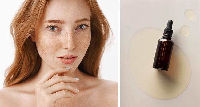 ТОП-8 средств против пигментации на лице и теле фото