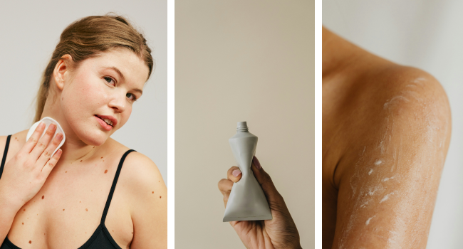 Лечение атопического дерматита у детей и взрослых фото