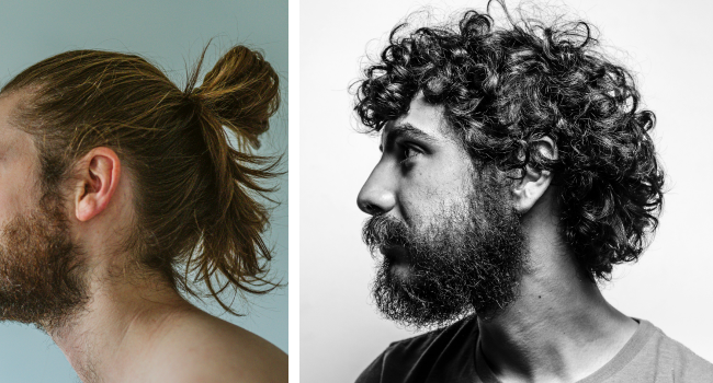 Выпадение волос у мужчин фото