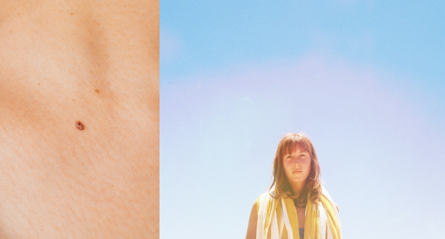 Рак кожи и солнцезащитные средства фото