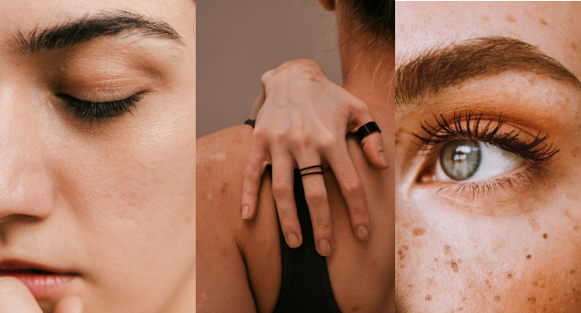 Сыворотка от пигментных пятен фото